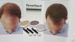 hair loss concealer men and women